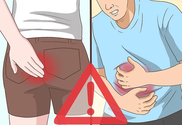 Рак прямой кишки