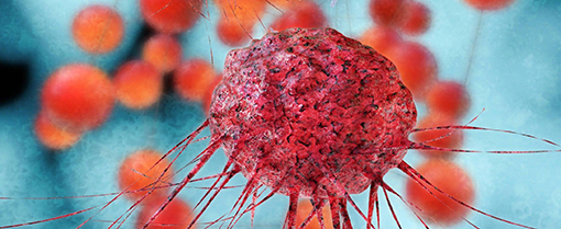 Гастроинтестинальные стромальные опухоли