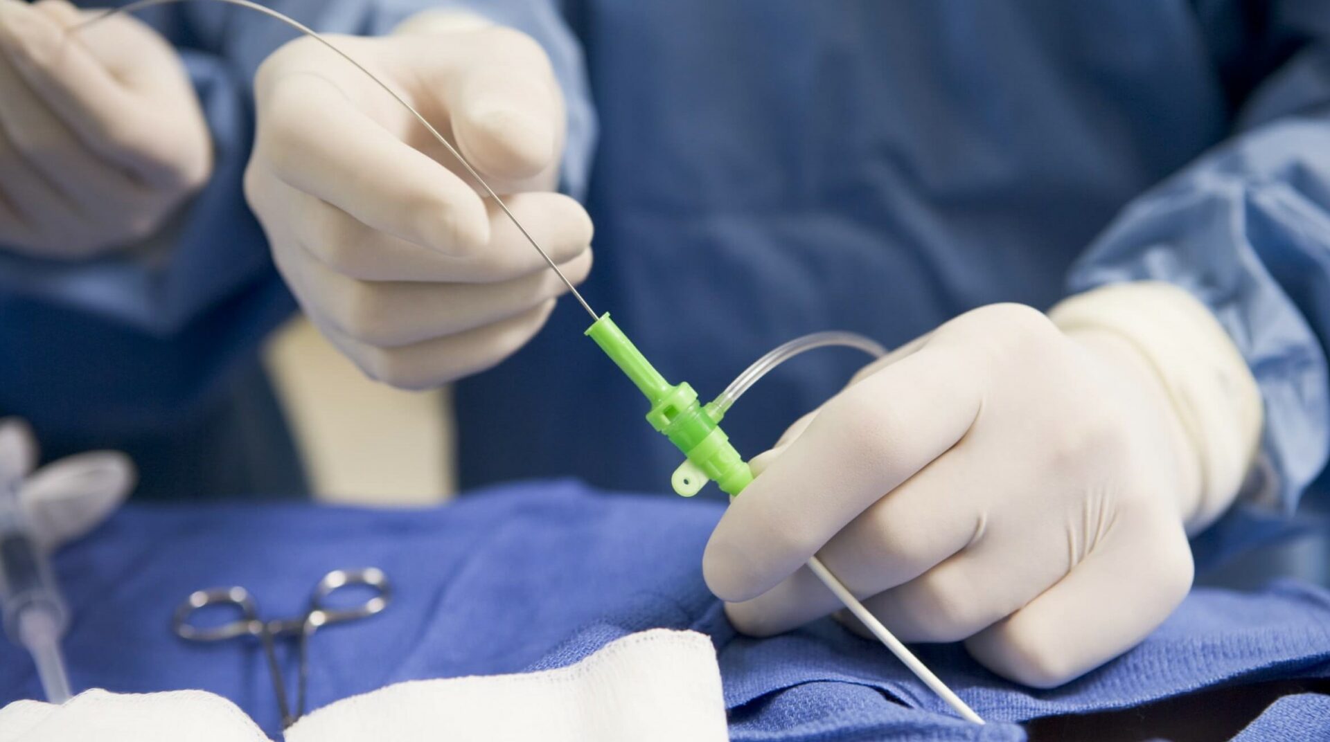 Эндоваскулярная хирургия