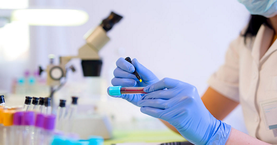 Простой герпес