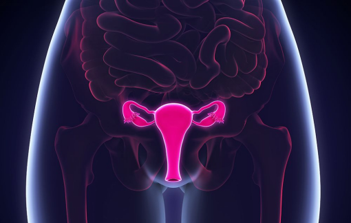 Рак влагалища