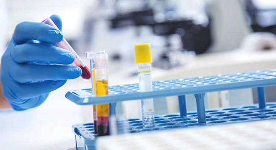 Ревматоидный артрит