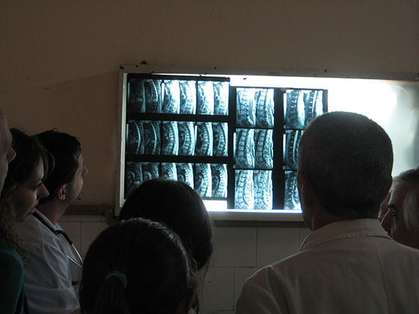 МРТ позвоночника