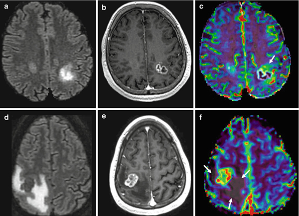 МРТ головы с контрастом