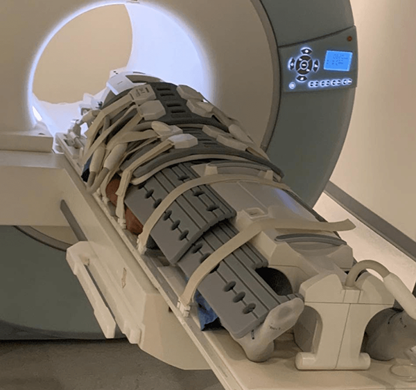 МРТ всего тела