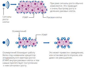 Немелкоклеточный рак легкого (НМРЛ)