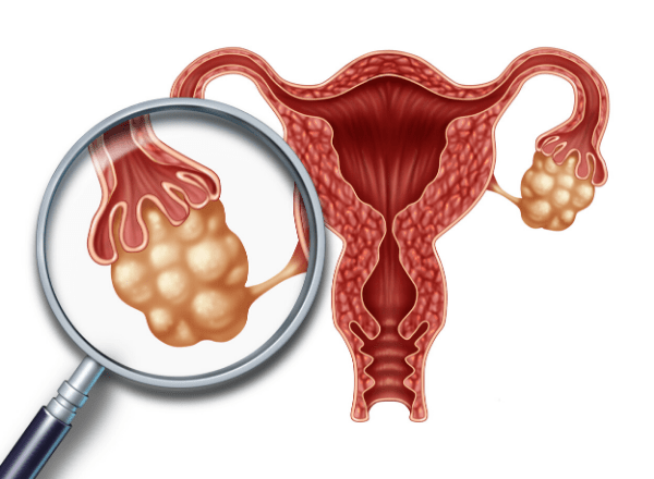 Фолликулометрия