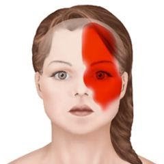 Головная боль