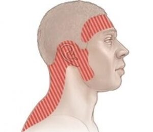 Головная боль