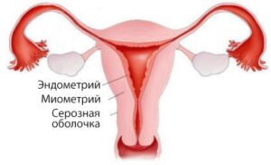 Рак эндометрия (рак тела матки) - симптомы и лечение