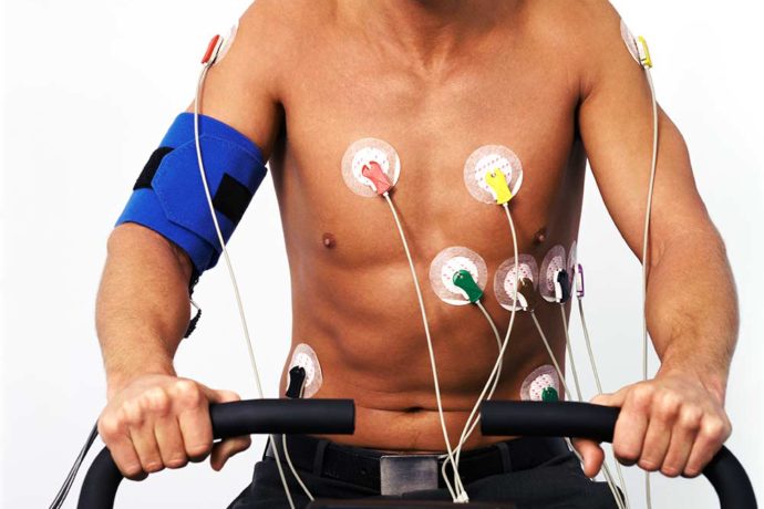 Стресс эхокардиография