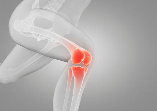 Замена коленного сустава