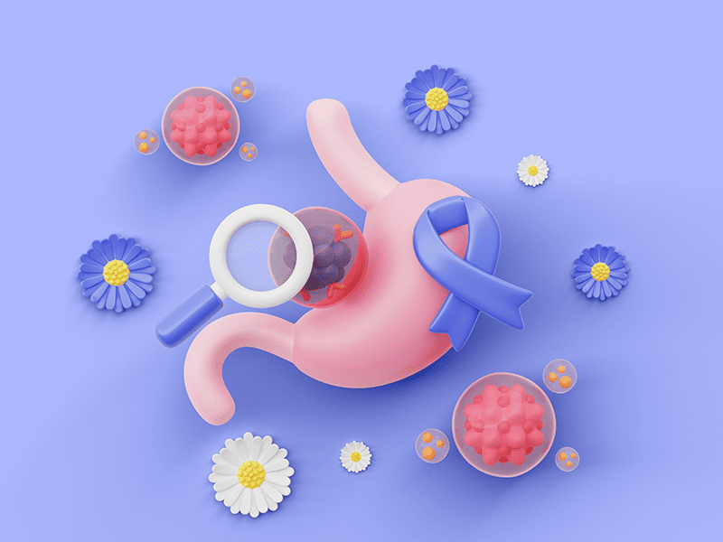 Аденокарцинома желудка-5