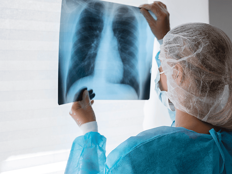 Аденокарцинома желудка-4