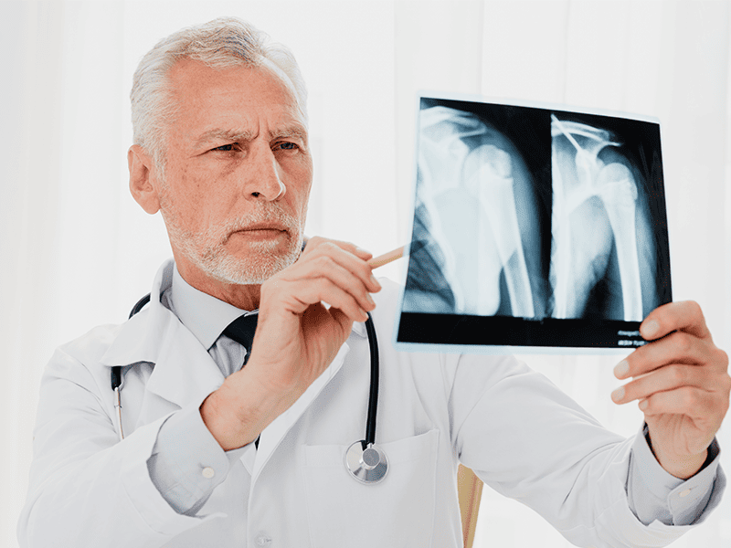 Хондросаркома-6