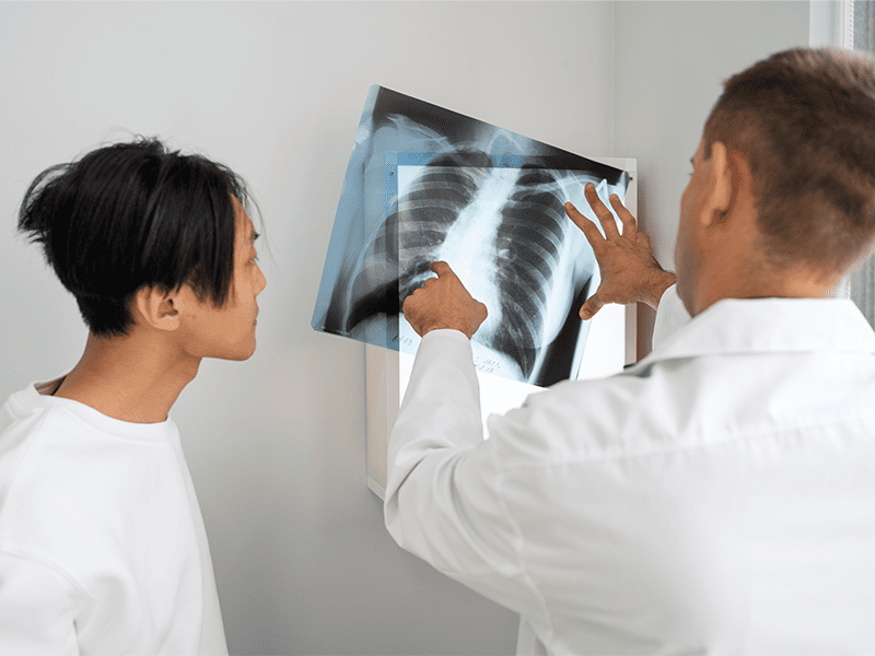 Мелкоклеточный рак легких-6