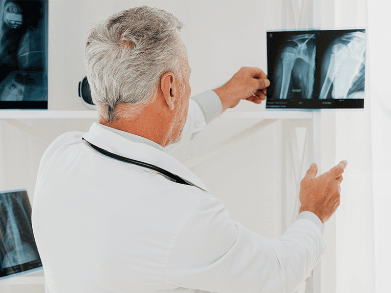 Лейомиосаркома-5