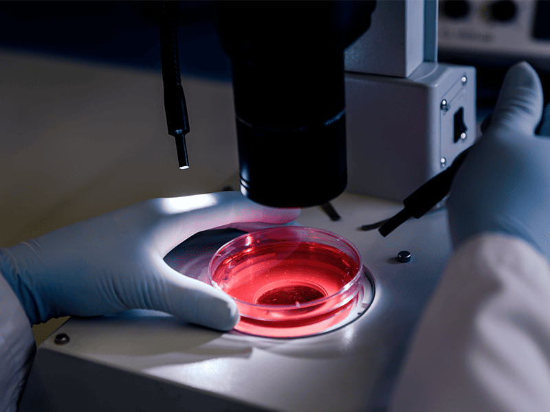 Миелодиспластический синдром-5