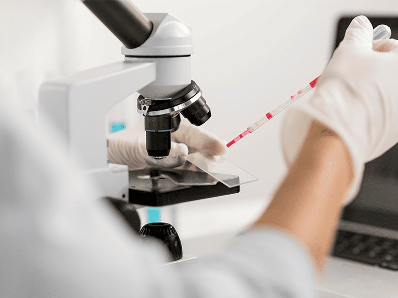 Миелодиспластический синдром-4