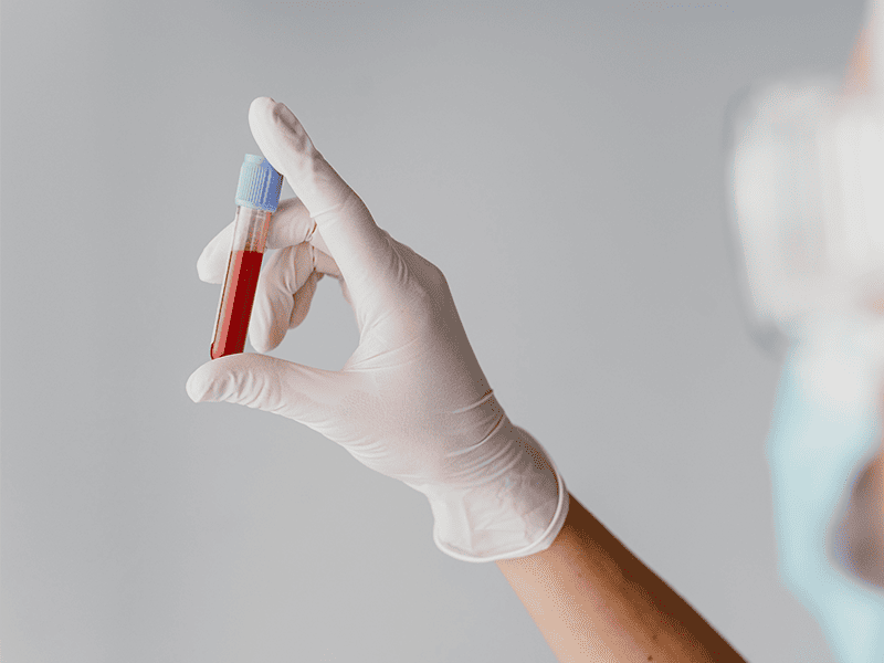 Миелодиспластический синдром-2