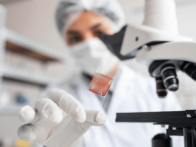 Лейомиосаркома-3